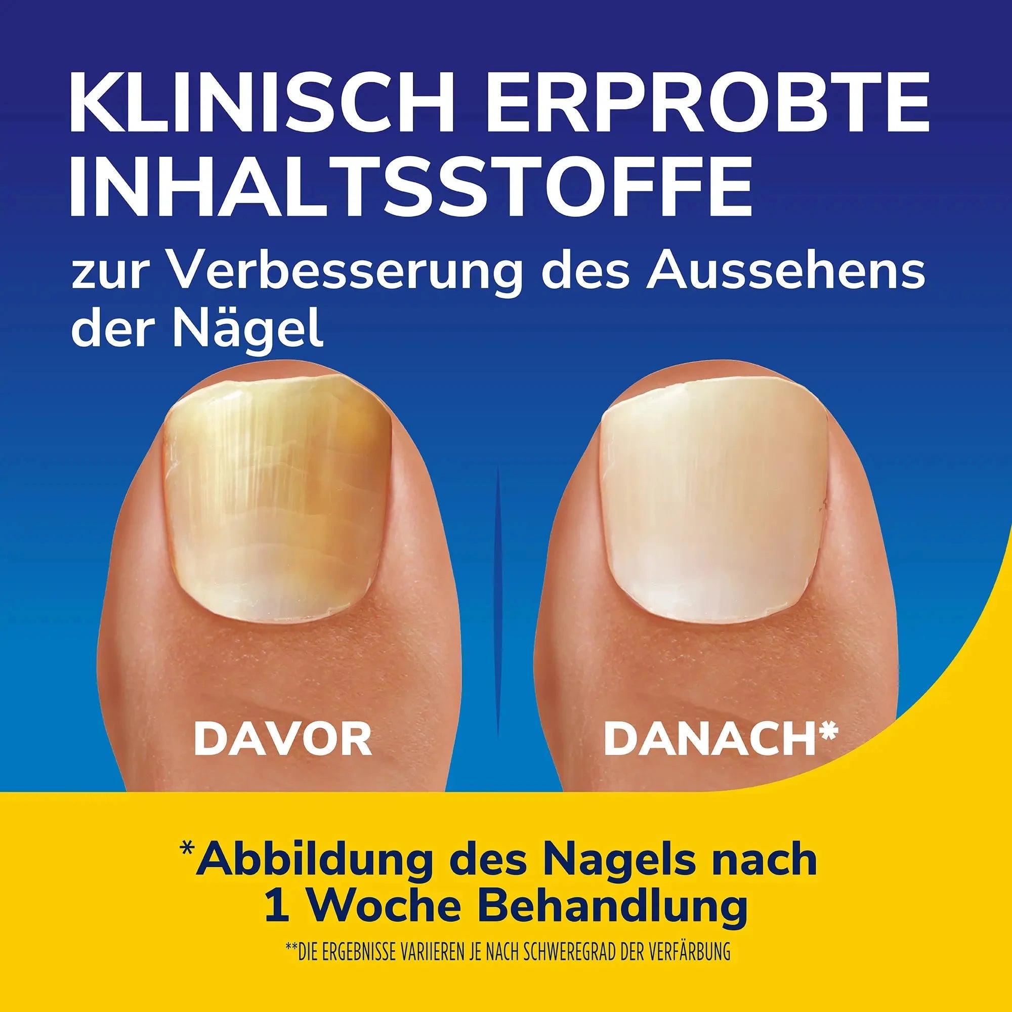dr-scholl-s-nagelrevitalisierer-10ml-serum image 3