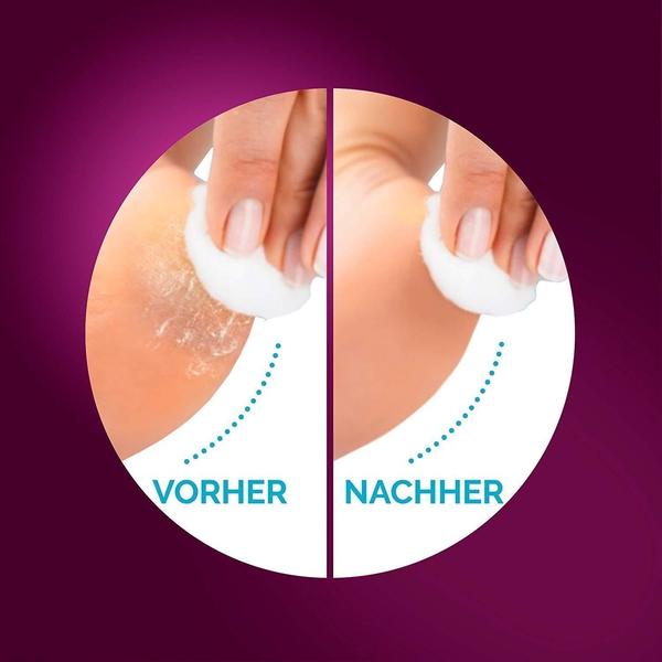 scholl-velvet-smooth-pro-elektrischer-hornhautentferner-wiederaufladbar-wasserdi image 4